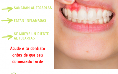 Tratamiento periodontal. Que es, cuando y como hacerlo.